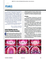 active-expander-arms-for-anterior-crossbite-resolution-albertini-pellitteri-albertini-siciliani-lomb