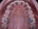 Igiene Orale Professionale - Prevenzione e Cura | Dr. Albertini Reggio Emilia