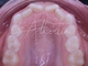 Ortodonzia Intercettiva Bambini - Prevenzione e Sviluppo | Dr. Albertini Reggio Emilia
