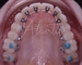 Professional Oral Hygiene - Prevention and Care | Dr. Albertini Reggio Emilia